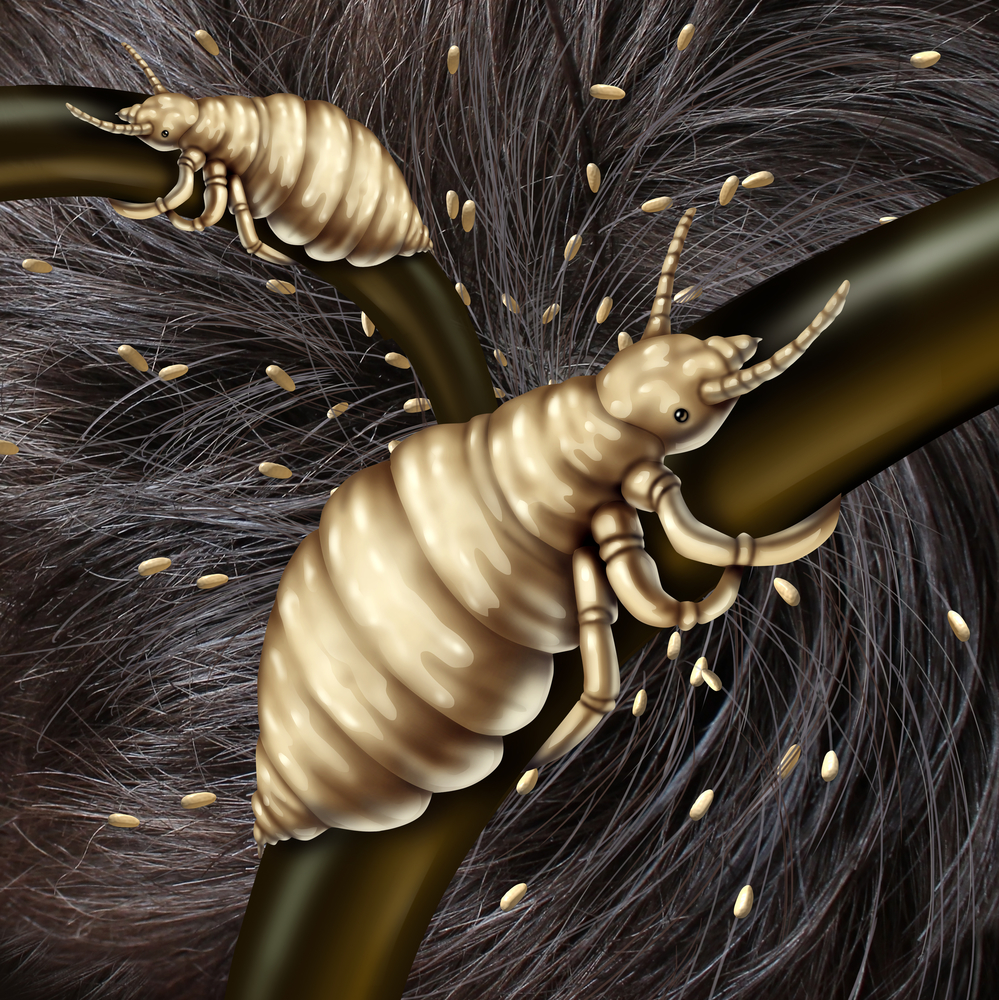 Head Lice And The Other Types - Lice Clinics of Texas