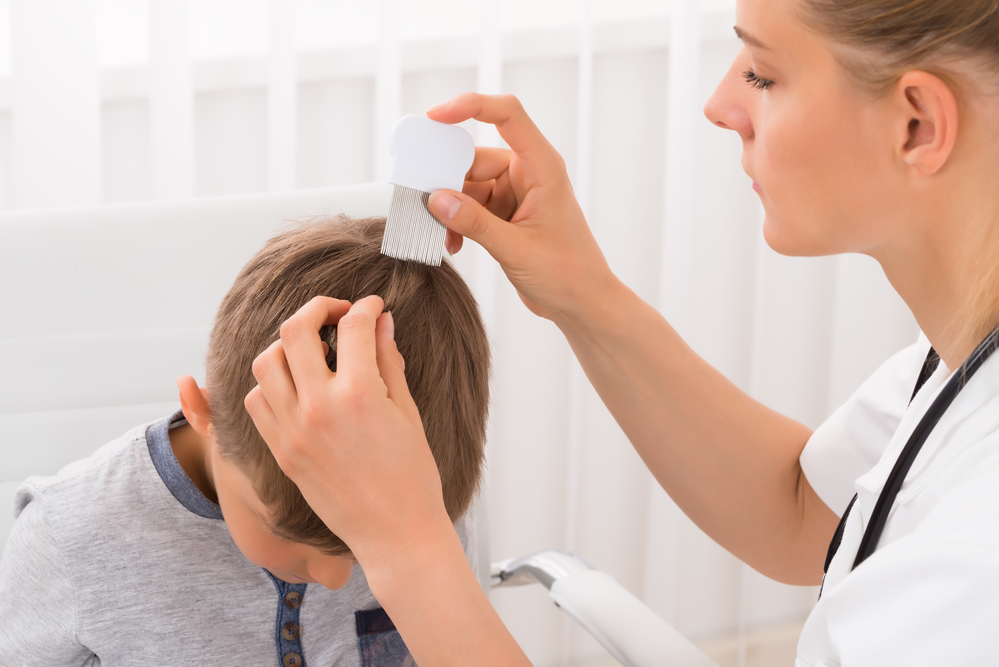 Most Common Ways People Catch Lice