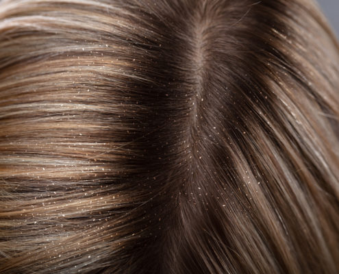 Lice Clinics Of America Houston Austin San Antonio Tx