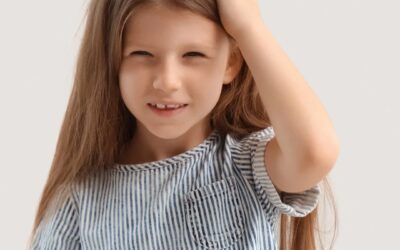 Dandruff vs Lice: How to tell the difference